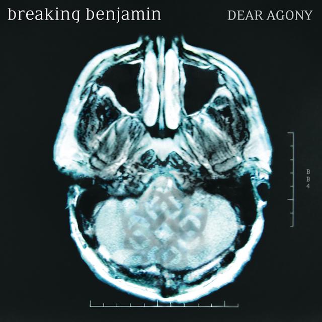 Album cover art for Dear Agony